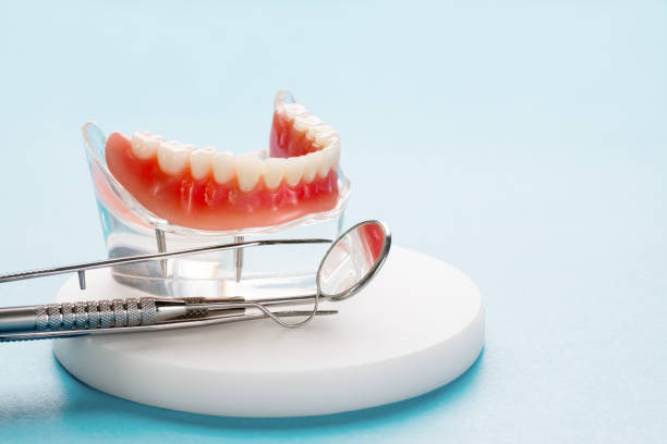 Dental Inlays and Onlays in Shawneetown, IL